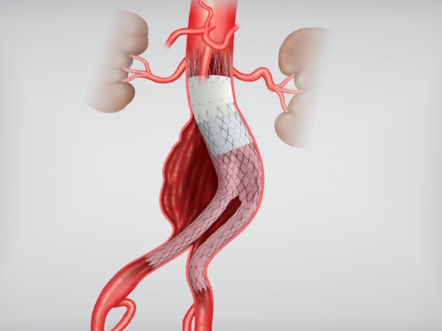 &Alpha;&nu;&epsilon;ύ&rho;&upsilon;&sigma;&mu;&alpha; &Kappa;&omicron;&iota;&lambda;&iota;&alpha;&kappa;ή&sigmaf; &Alpha;&omicron;&rho;&tau;ή&sigmaf;