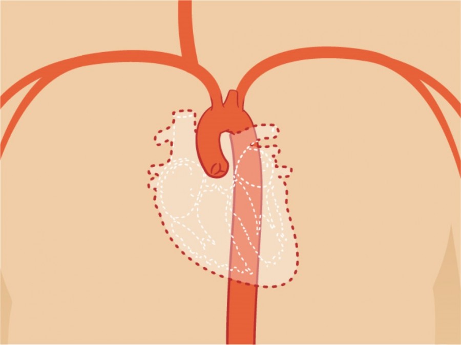 &Alpha;&omicron;&rho;&tau;&iota;&kappa;ό&sigmaf; &Delta;&iota;&alpha;&chi;&omega;&rho;&iota;&sigma;&mu;ό&sigmaf;