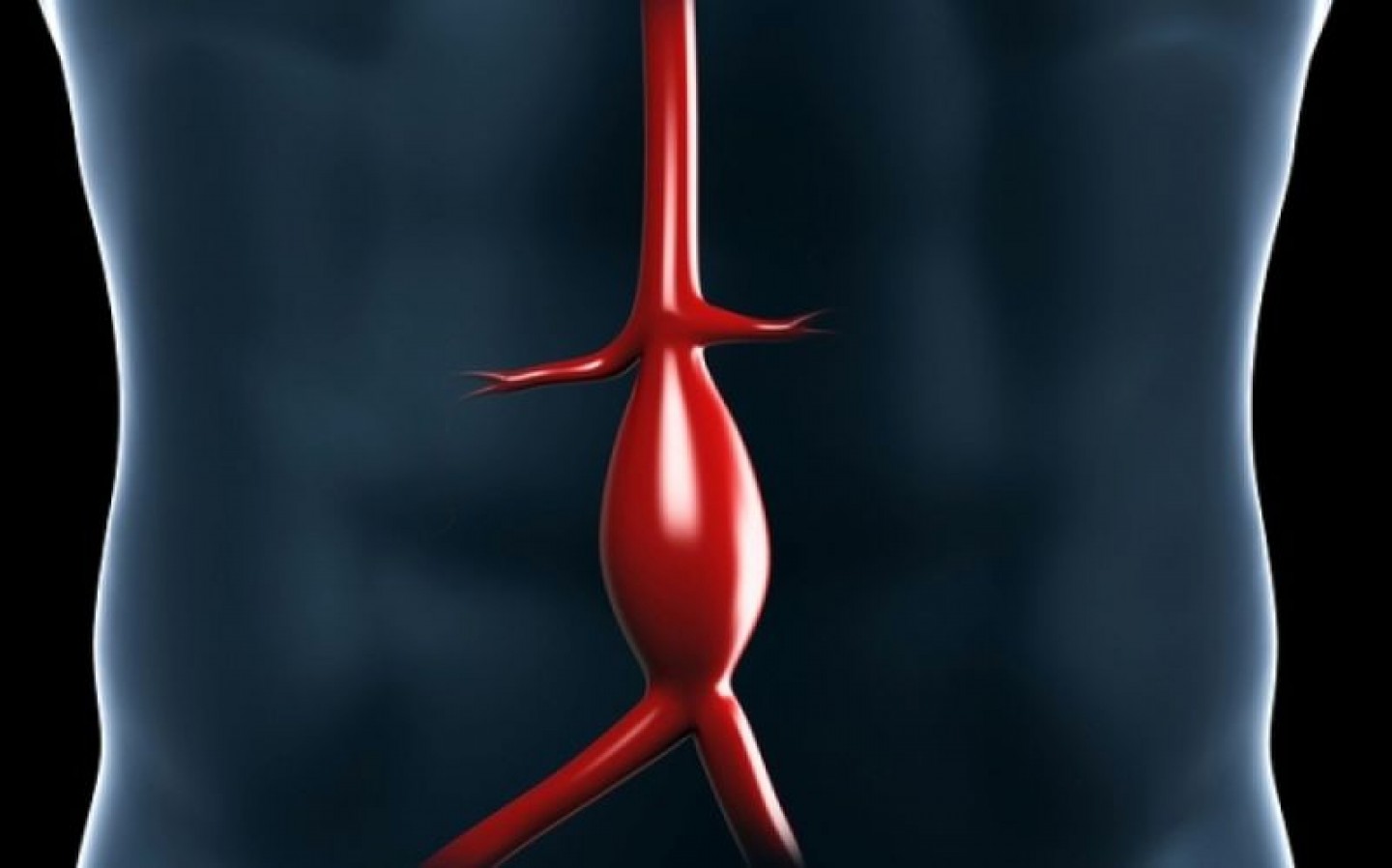 Ανεύρυσμα Κοιλιακής Αορτής: Πότε και πώς πρέπει να ελεγχθώ για αυτή την ύπουλη πάθηση;