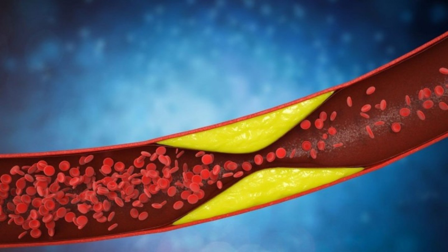 &Theta;&rho;ό&mu;&beta;&omega;&sigma;&eta;: &Mu;&iota;&alpha; &laquo;ύ&pi;&omicron;&upsilon;&lambda;&eta;&raquo; &alpha;&sigma;&theta;έ&nu;&epsilon;&iota;&alpha; &pi;&omicron;&upsilon; &mu;&alpha;&sigmaf; &alpha;&phi;&omicron;&rho;ά ό&lambda;&omicron;&upsilon;&sigmaf; (athensmagazine.gr 13-10-2022)