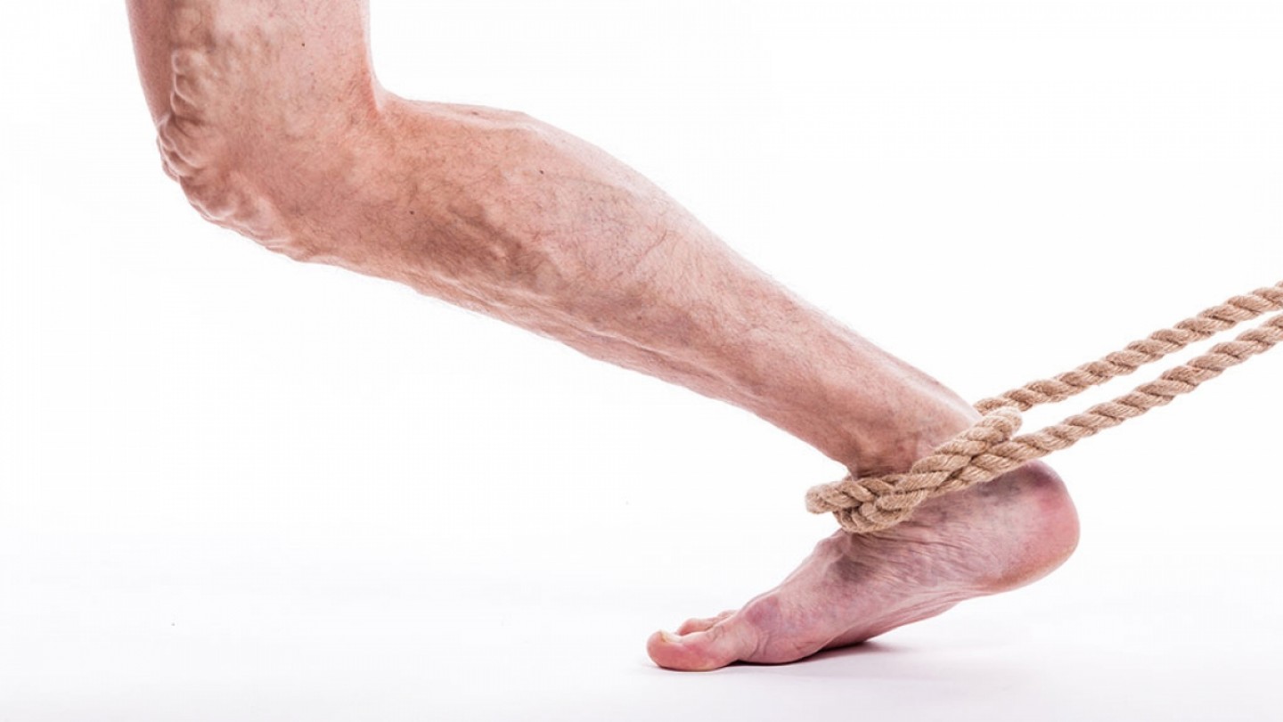 Όλα όσα πρέπει να γνωρίζετε για κιρσούς και ευρυαγγείες, πριν χτυπήσετε την πόρτα του γιατρού (iatrikostypos.com / 5-10-18)