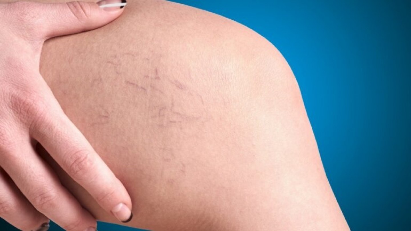 &Phi;&lambda;&epsilon;&beta;&iota;&kappa;έ&sigmaf; &pi;&alpha;&theta;ή&sigma;&epsilon;&iota;&sigmaf;: &Alpha;&nu;&alpha;&zeta;&eta;&tau;ή&sigma;&tau;&epsilon; &tau;&omicron;&nu; &kappa;&alpha;&tau;ά&lambda;&lambda;&eta;&lambda;&omicron; &alpha;&gamma;&gamma;&epsilon;&iota;&omicron;&chi;&epsilon;&iota;&rho;&omicron;&upsilon;&rho;&gamma;ό (zougla.gr 20-3-2023)